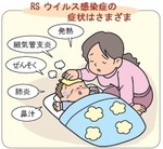 Various symptoms of  Respiratory Syncytial virus infection